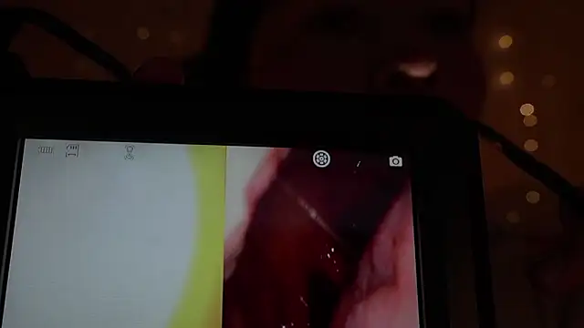 nerak 1a  online show from 11-12-25, 06:34