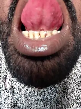 ListedLoin online show from 11-18-25, 07:33